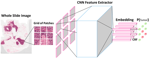 Convolutional Neural Network